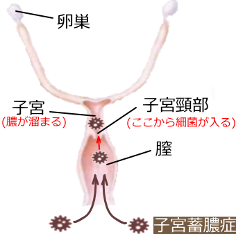 子宮蓄膿症 しきゅうちくのうしょう メスの生殖器 犬の病気サイト 犬の病気 症状 健康の教科書